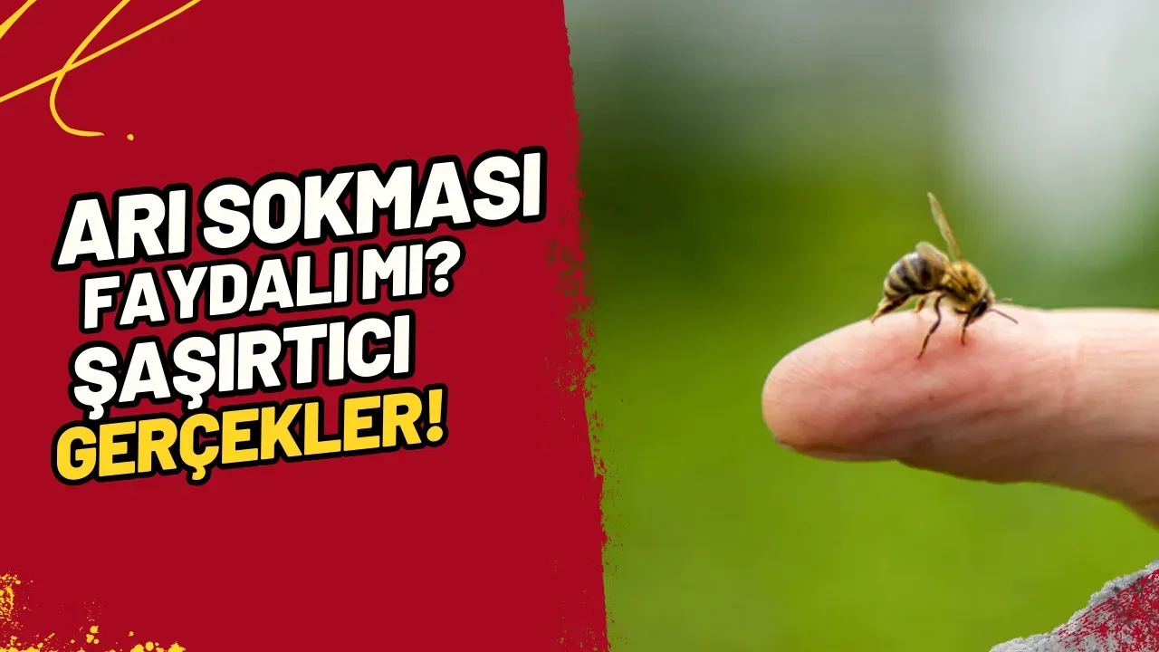 Arı Sokması Faydalı mı? Şaşırtıcı Gerçekler!