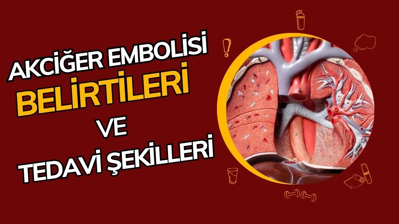 Akciğer Embolisi Nedir? Belirtileri, Risk Faktörleri ve Hayati Önemi!