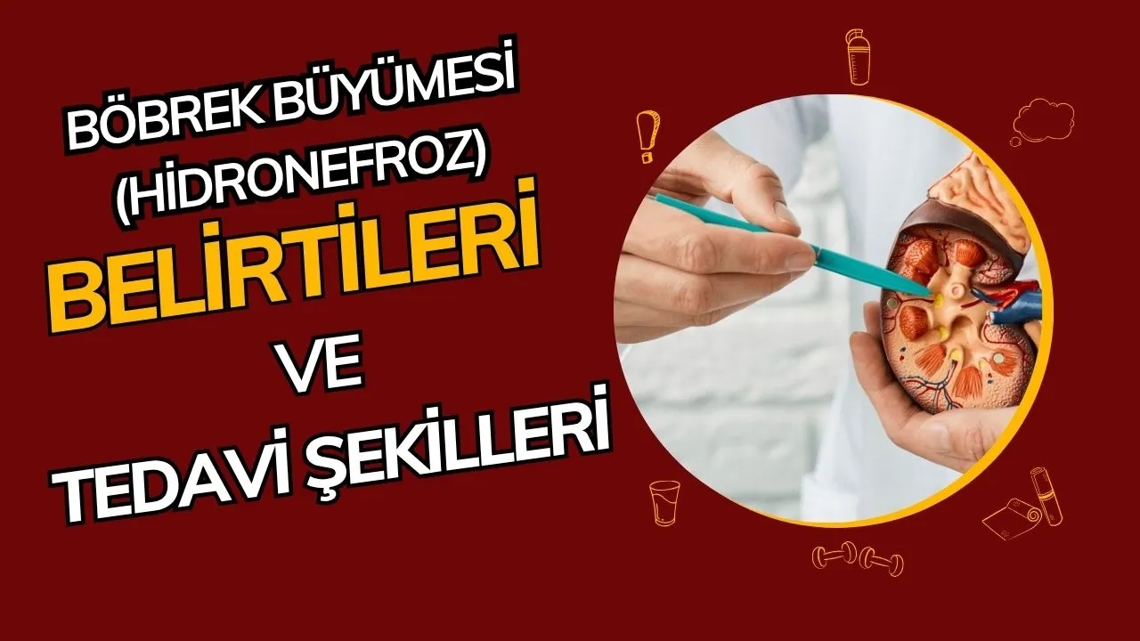 Böbrek Büyümesi (Hidronefroz) Nedir? Belirtileri, Nedenleri ve Tedavi Yöntemleri