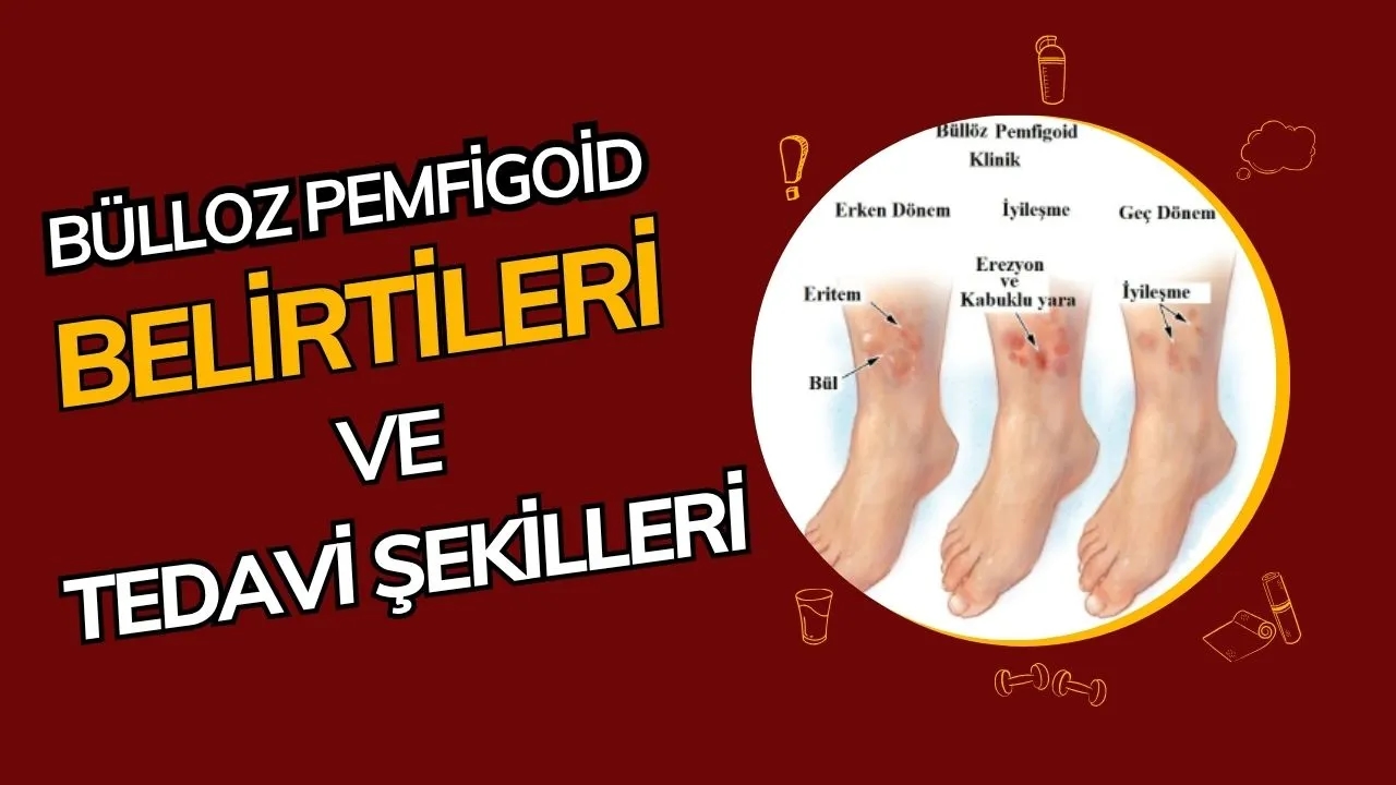 Büllöz Pemfigoid Nedir? Ciltte Kabarcıklara Neden Olan Bu Hastalığı Yakından Tanıyın