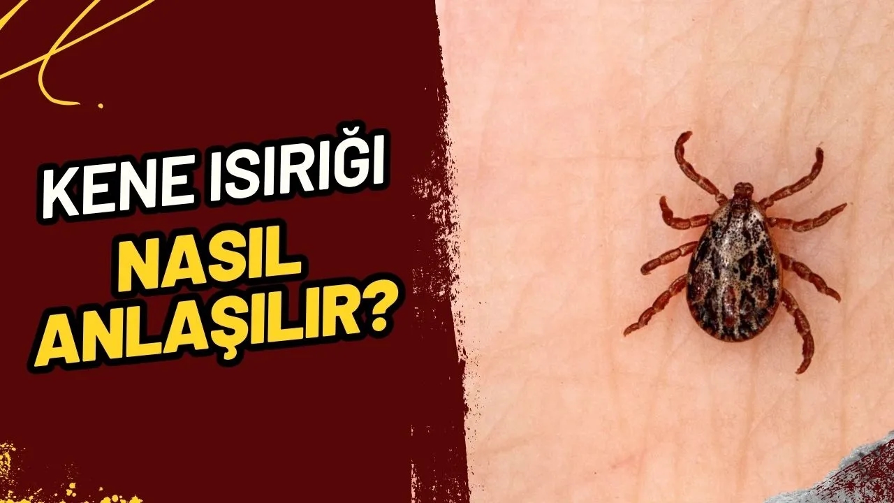 Kene Isırığı Nasıl Anlaşılır ve Kene Isırırsa Ne Yapmalı? Hayati Bilgiler!