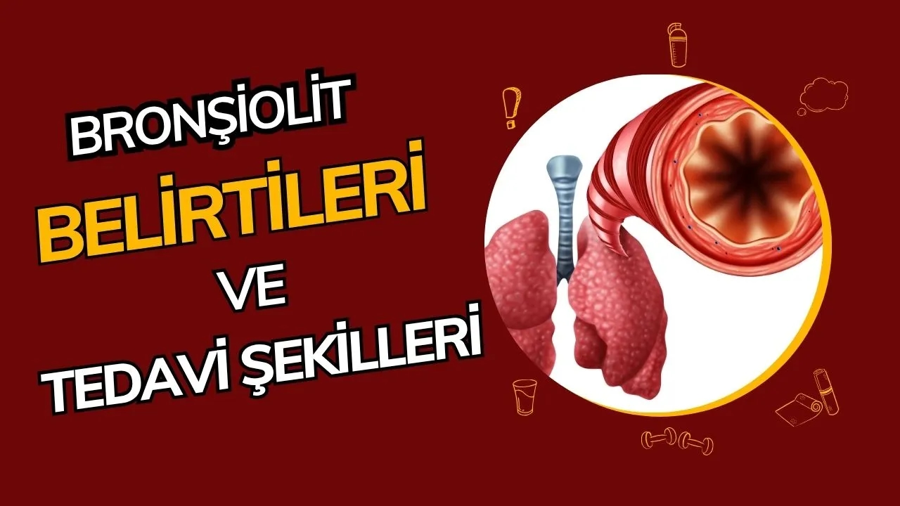 Bronşiolit Nedir? Bebeklerde Sık Görülen Bu Solunum Yolu Hastalığını Tanıyın