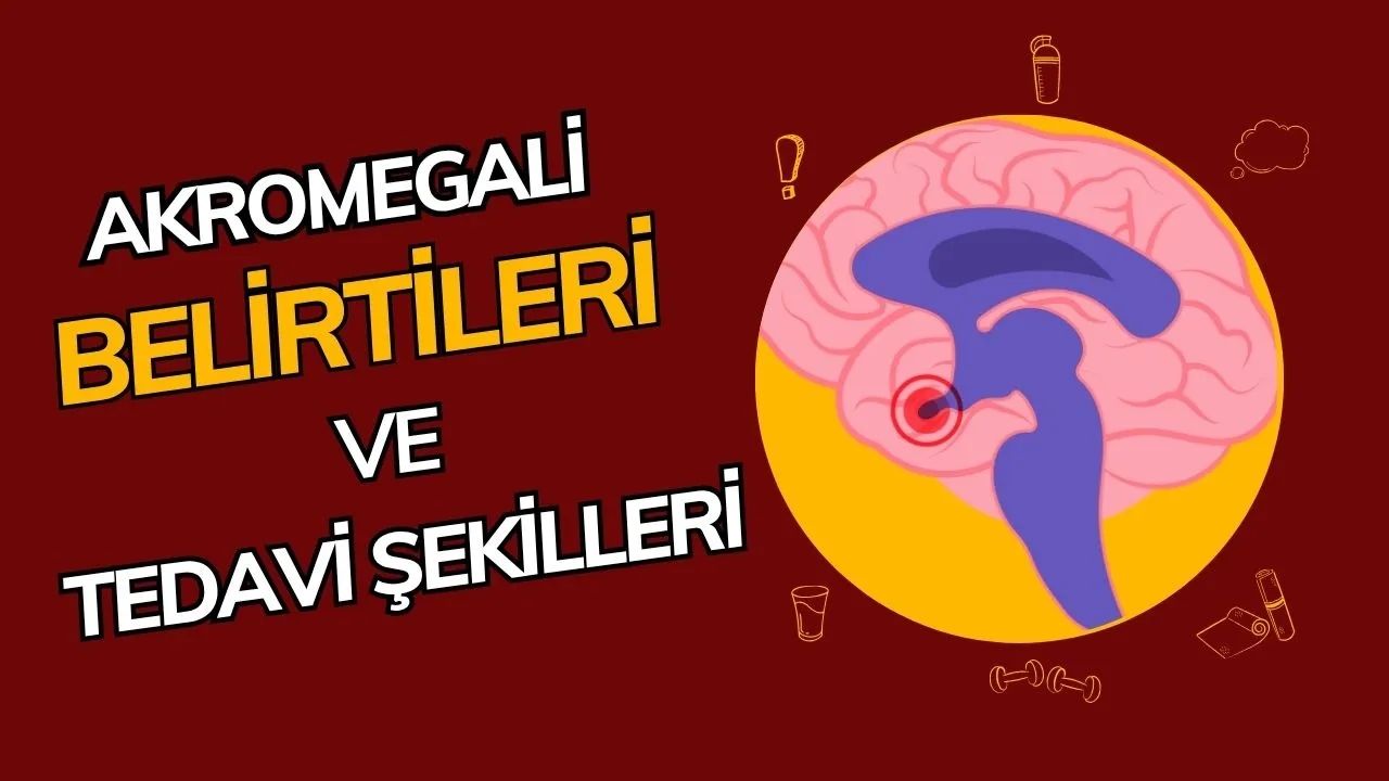 Akromegali Hastalığı Nedir? Belirtileri, Nedenleri ve Tedavi Yöntemleri