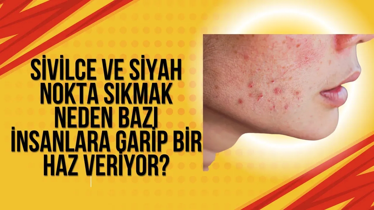 Sivilce ve Siyah Nokta Sıkmak Neden Bazı İnsanlara Garip Bir Haz Veriyor?