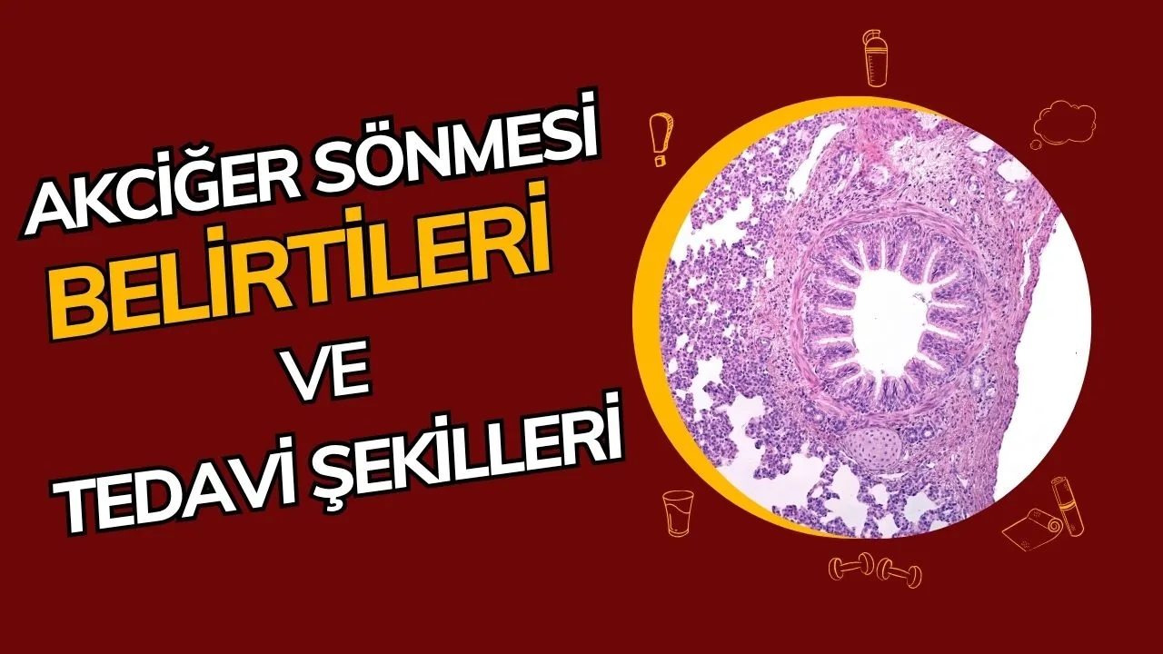 Akciğer Sönmesi Nedir? Pnömotoraks Belirtileri, Nedenleri ve Acil Müdahale!