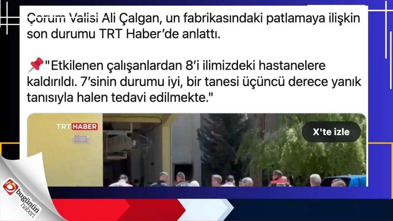 BUGÜNÜN HABERİ ÜST MANŞET (11).webp