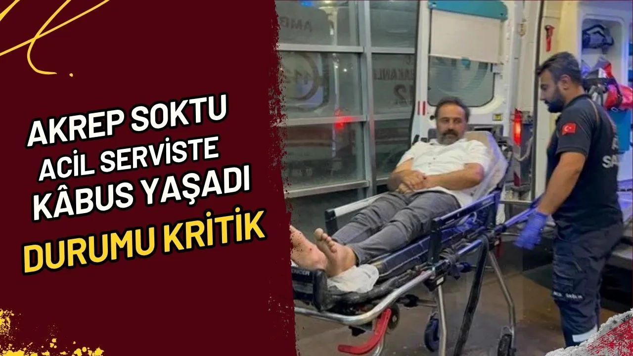 Akrep Soktu Acil Serviste Kâbus Yaşadı, Durumu Kritik mi?