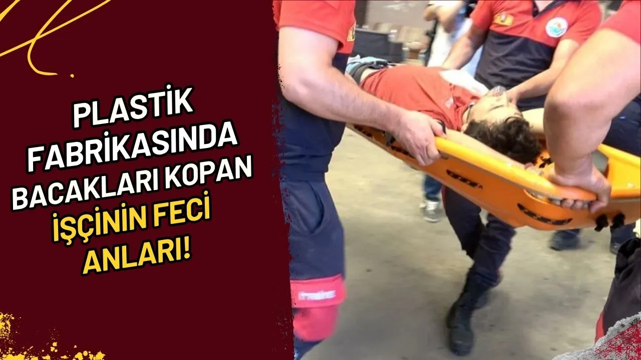 Plastik Fabrikasında Bacakları Kopan İşçinin Feci Anları!
