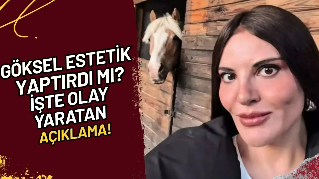 Göksel estetik yaptırdı mı? İşte olay yaratan açıklama!