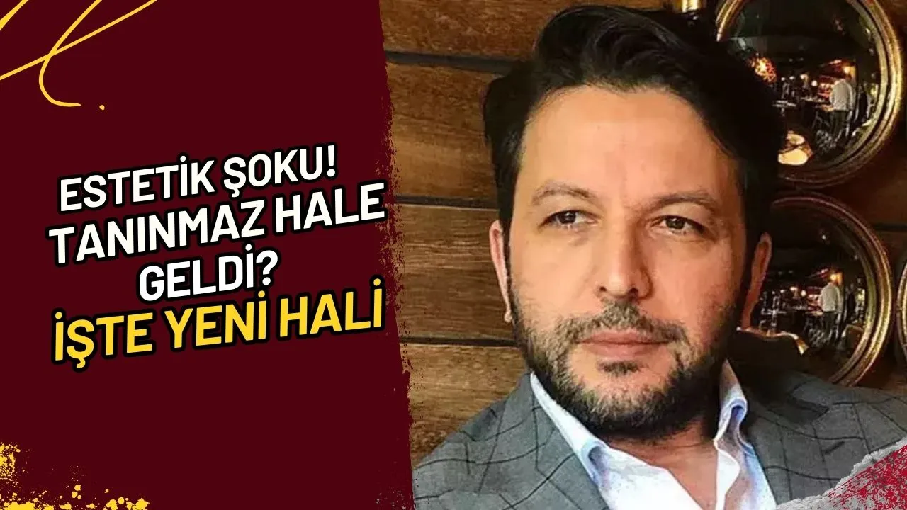 Estetik Şoku! Tanınmaz Hale Geldi? İşte Yeni Hali