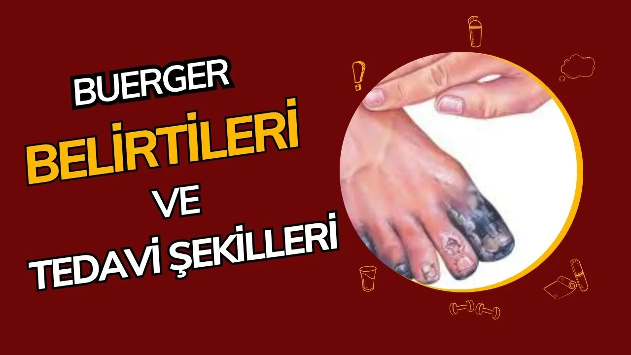 Buerger Hastalığı Nedir? Belirtileri, Nedenleri ve Tedavi Yöntemleri