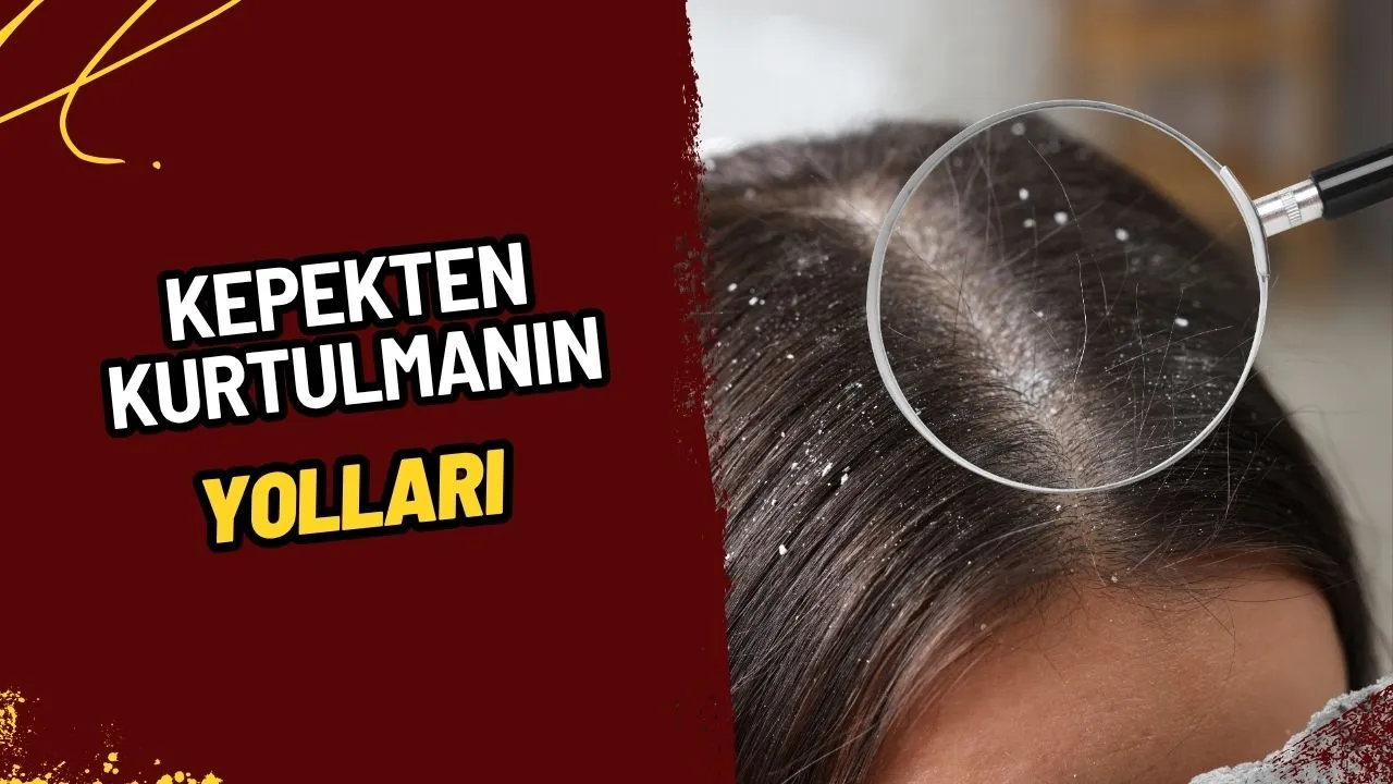 Kepekten Kurtulmanın Yolları: Sağlıklı Saç Derisi İçin Kesin Çözümler ve Doğal Yöntemler