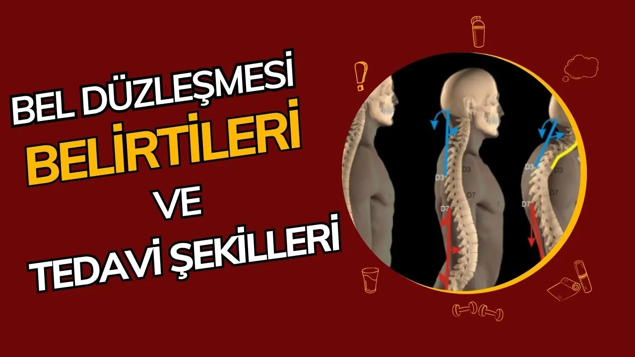 Bel Düzleşmesi (Hipolordoz) Nedir? Çağımızın Yaygın Omurga Sorunu ve Bilmeniz Gerekenler