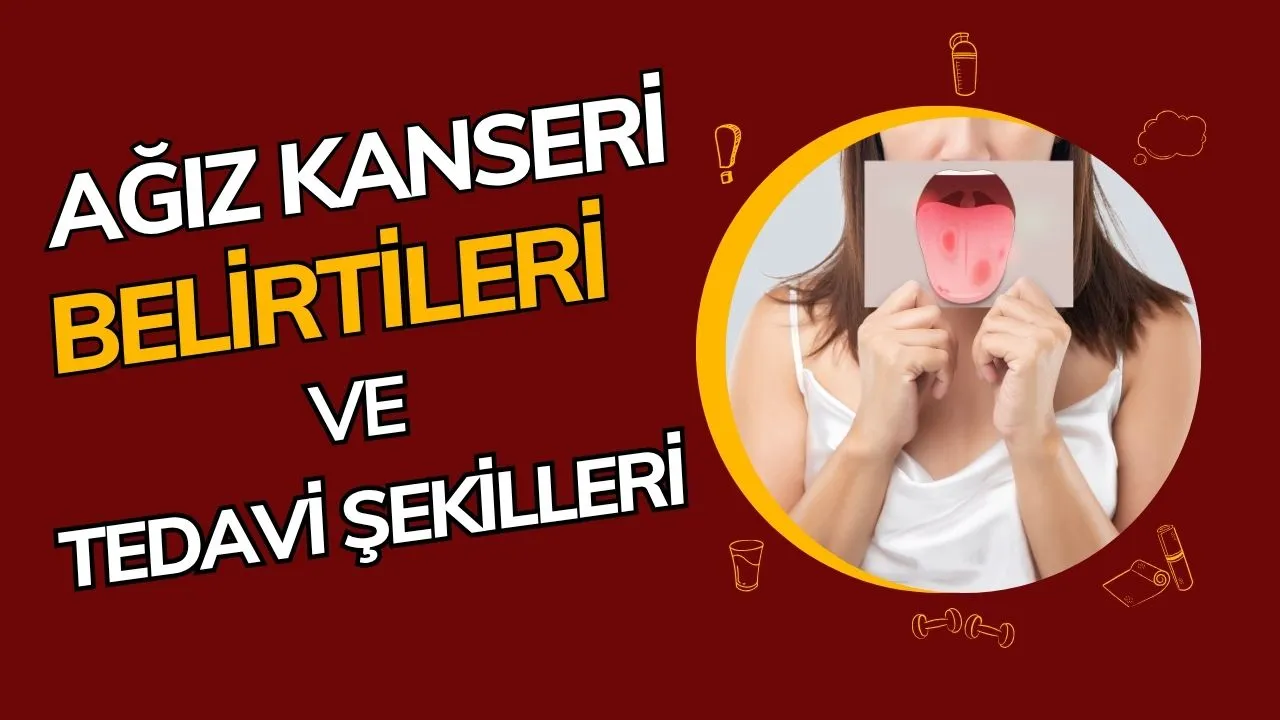 Ağız Kanseri Nedir? Belirtileri, Risk Faktörleri ve Erken Teşhisin Önemi