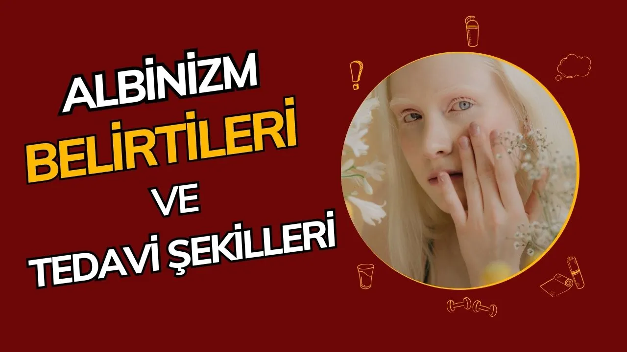 Albinizm Nedir? Belirtileri, Nedenleri ve Yaşam Kalitesi!