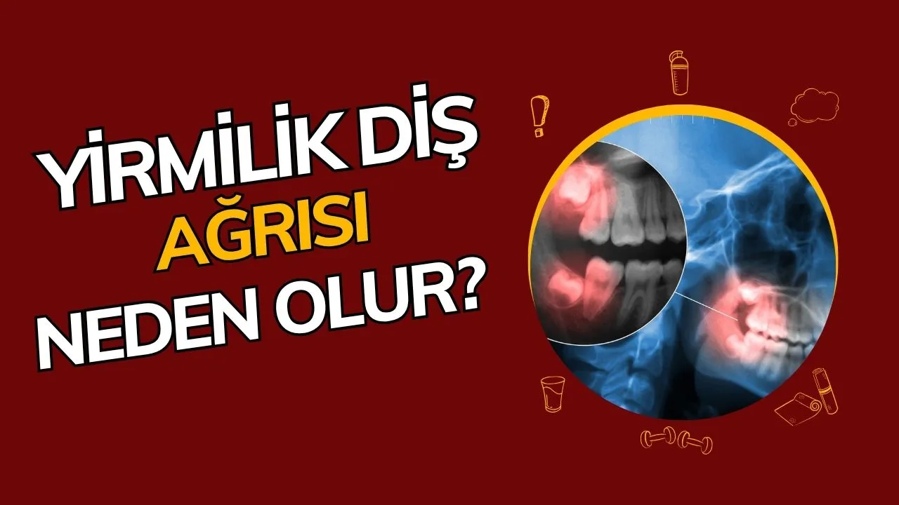 20'lik Diş Ağrısı Neden Olur? Çekim Sonrası Bilmeniz Gereken Her Şey!