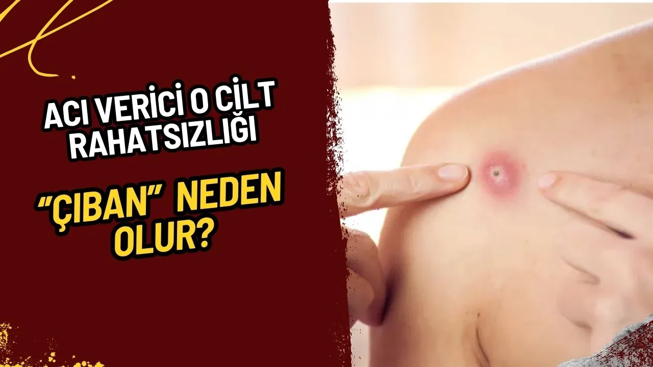 Çıban Nedir? Nedenleri, Belirtileri, Korunma Yolları ve Tedavisi